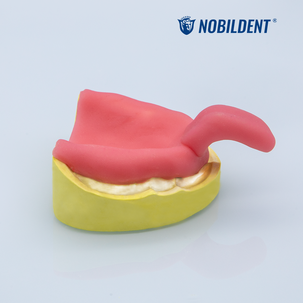 Light Curing Tray