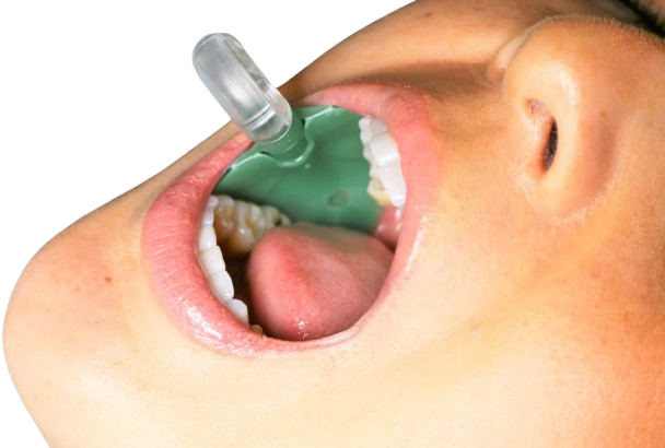 ReLeaf® Hands-Free High Volume Dental Suction System | 100 / Bag